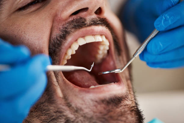 Best Broken or Chipped Tooth Repair in Fearrington Village, NC