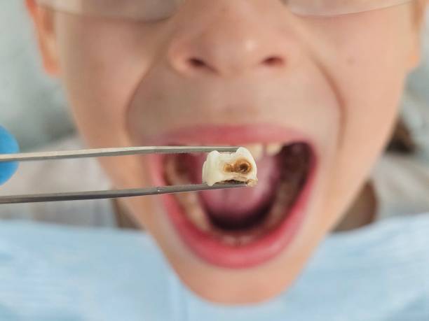 Best Emergency Cosmetic Dentistry (e.g., broken veneers) in Fearrington Village, NC